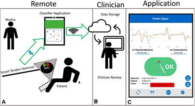 A Smart Tendon Hammer System for Remote Neurological Examination